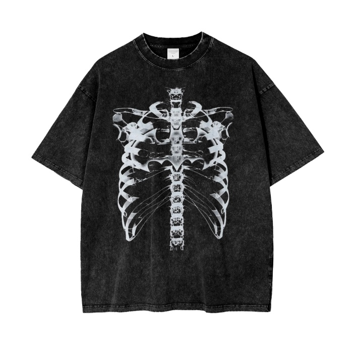 X-Ray Tee